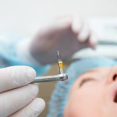 dentist holding dental implant during surgery