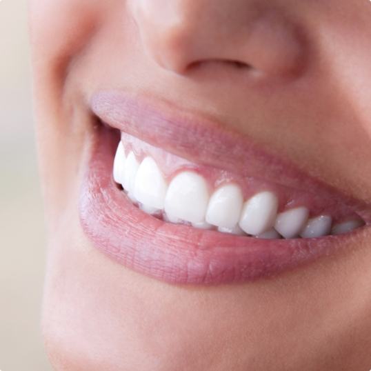 Closeup of smile after gum recontouring