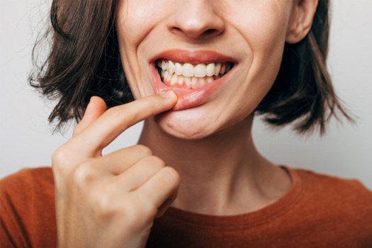 A woman with bleeding gums near Somerset.