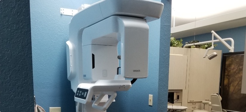 3 D C T cone beam digital x ray scanner